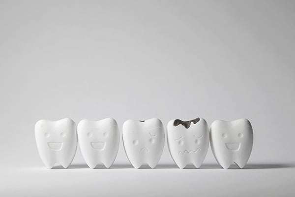 How a General Dentist Can Treat Tooth Decay