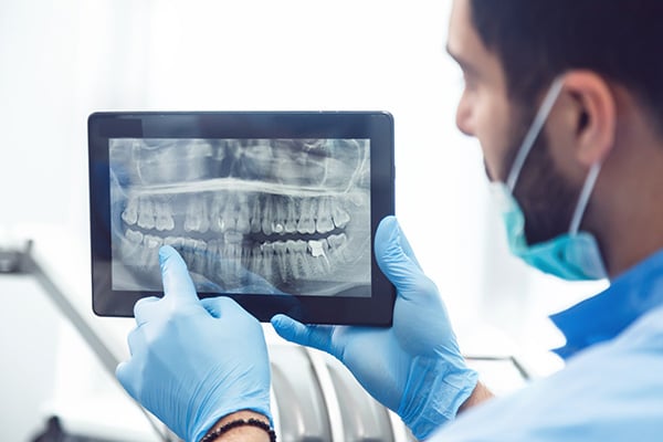 General Dentistry: Are Dental X-rays Recommended?