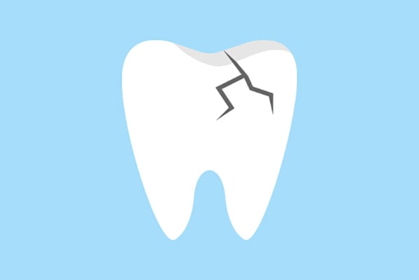 General Dentistry Treatments for a Damaged Tooth