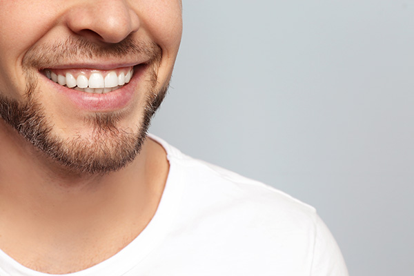 Teeth Whitening Treatments Performed by a General Dentist