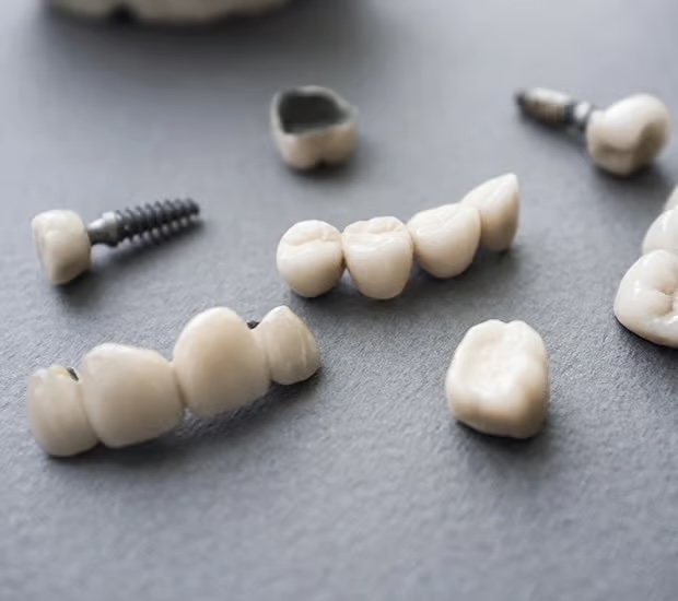 Difference Between Dental Implants and Mini Dental Implants