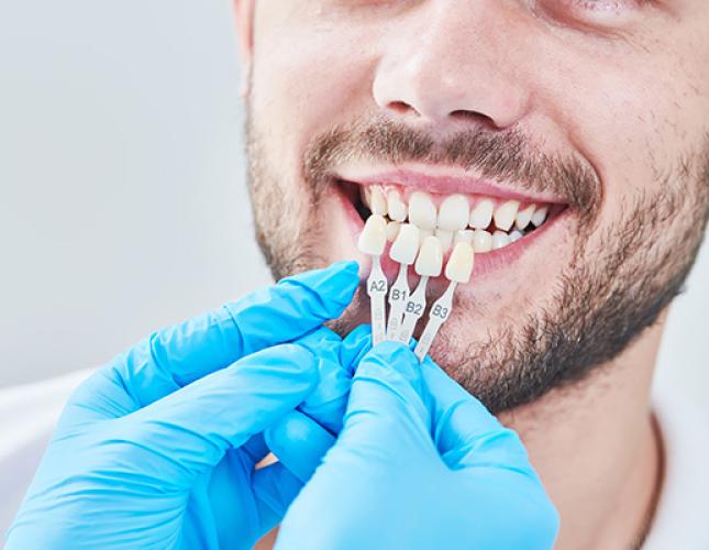 How Dental Veneers Are Used in General Dentistry